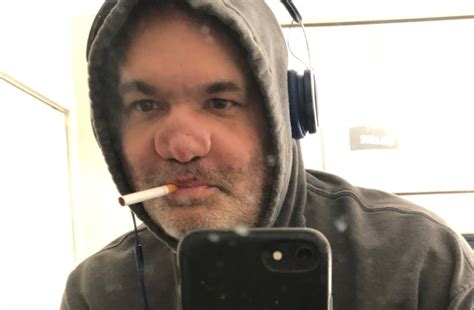 Comedian Artie Lange shares photo of nose after 3 decades of